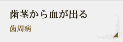 歯茎から血が出る 歯周病