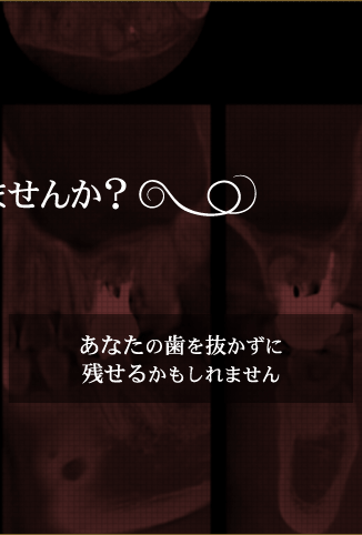 あなたの歯を抜かずに残せるかもしれません